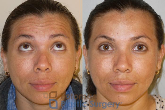 Before & After Skin Care Case 53 Front View #3 View in Washington, DC